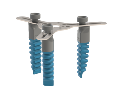 SG.C.PL.50.3V1 Drei Finger Zentrischer Industrialgreifer mit variablem Fingerabstand SG.C.PL.50.3V1.png